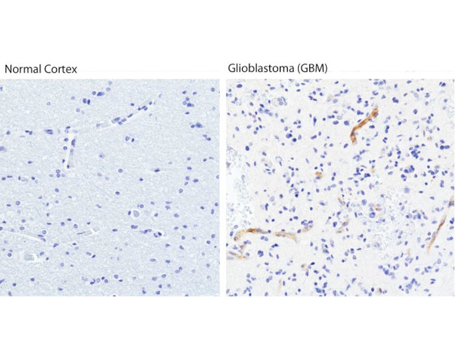 VEGF Receptor 2 Antibody in Immunohistochemistry (Paraffin) (IHC (P))