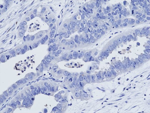 WT1 Antibody in Immunohistochemistry (Paraffin) (IHC (P))