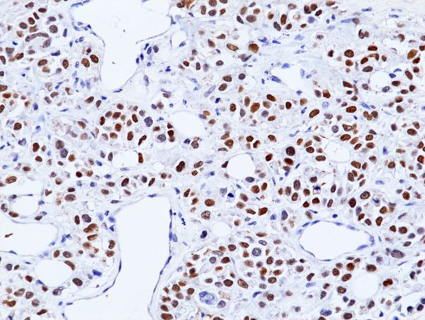 TRPS1 Antibody in Immunohistochemistry (Paraffin) (IHC (P))