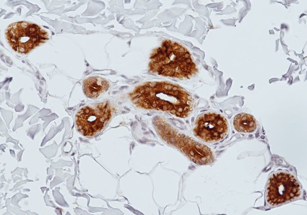 Mammaglobin A Antibody in Immunohistochemistry (Paraffin) (IHC (P))