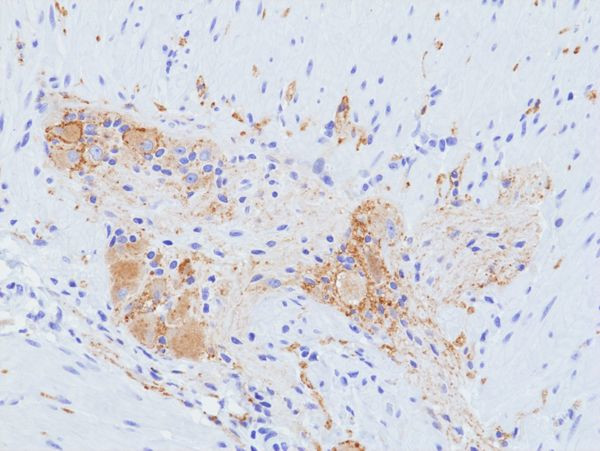 SV2A Antibody in Immunohistochemistry (Paraffin) (IHC (P))