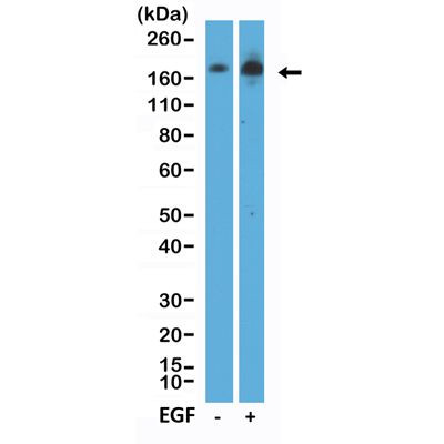 Phospho-EGFR (Tyr1068) Antibody in Western Blot (WB)