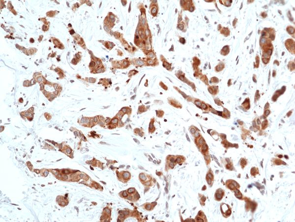 Phospho-GSK3B (Ser9) Antibody in Immunohistochemistry (Paraffin) (IHC (P))