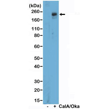 Phospho-ULK1 (Ser757) Antibody in Western Blot (WB)