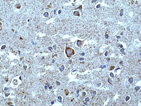 alpha Synuclein Antibody in Immunohistochemistry (Paraffin) (IHC (P))