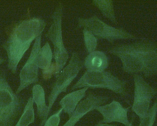 beta Tubulin Antibody in Immunocytochemistry (ICC/IF)