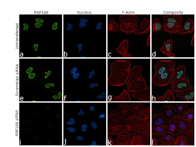 RNF168 Antibody in Immunocytochemistry (ICC/IF)