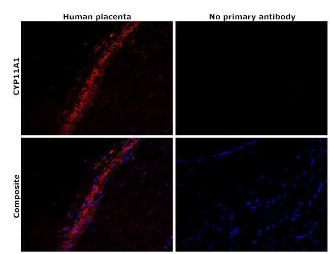 CYP11A1 Antibody in Immunohistochemistry (Paraffin) (IHC (P))