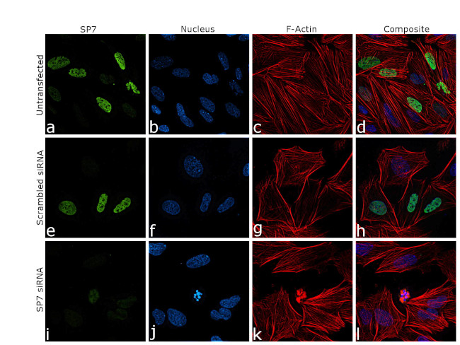 Sp7 Material SP7 Recombinant Rabbit Monoclonal Antibody (PSH07-29) | Invitrogen ...
