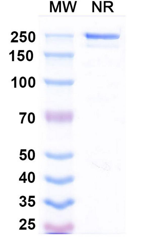 Suciraslimab Antibody in SDS-PAGE (SDS-PAGE)