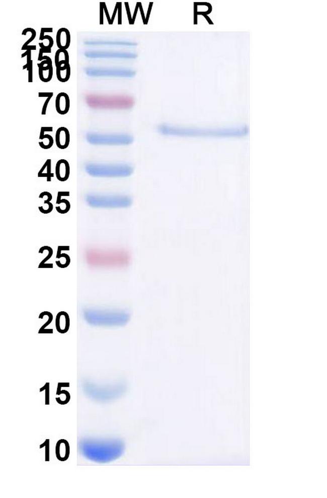 Acimtamig Antibody in SDS-PAGE (SDS-PAGE)