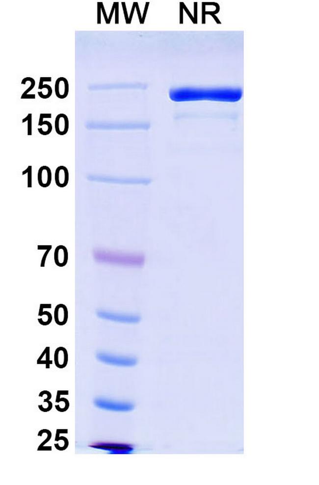 Rademikibart Antibody in SDS-PAGE (SDS-PAGE)