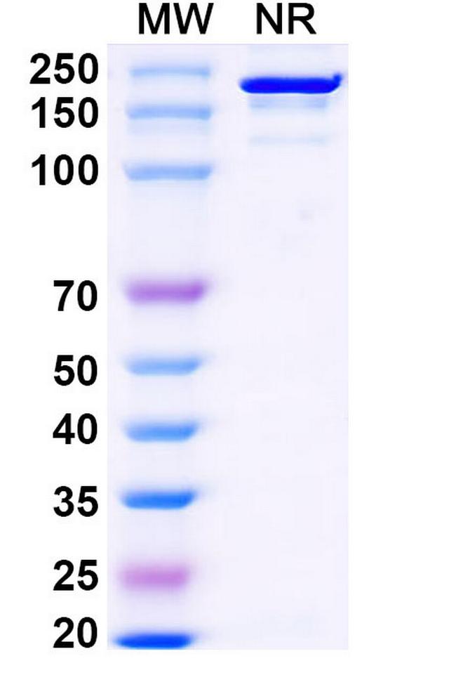 Falbikitug Antibody in SDS-PAGE (SDS-PAGE)