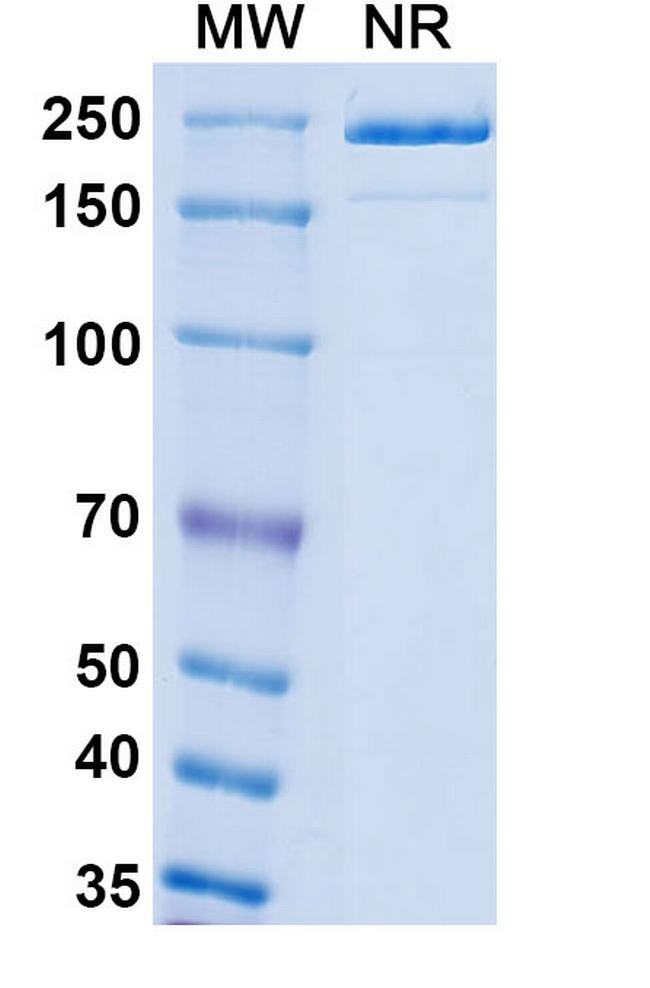 Endothelin A Receptor (Patecibart Biosimilar) Antibody in SDS-PAGE (SDS-PAGE)