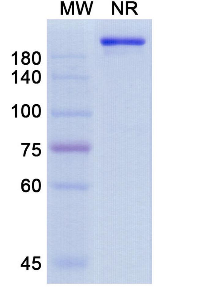 Ensomafusp Alfa Humanized Antibody in SDS-PAGE (SDS-PAGE)