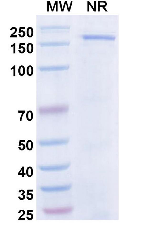 Dibotatug Antibody in SDS-PAGE (SDS-PAGE)