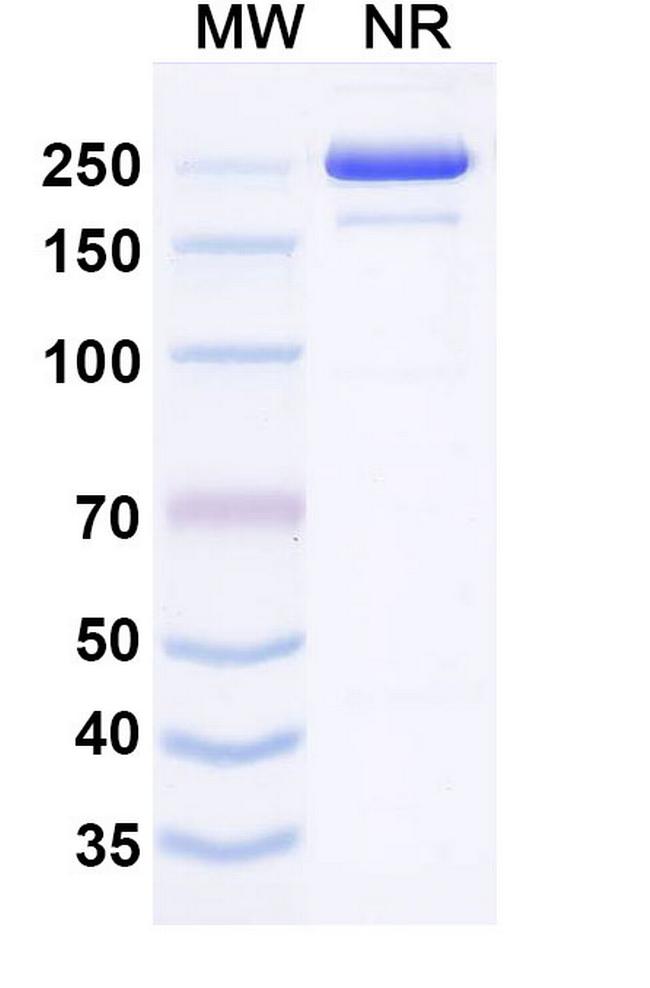 Izeltabart Antibody in SDS-PAGE (SDS-PAGE)