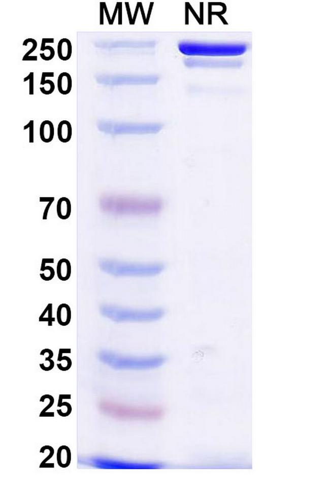 Votumumab Antibody in SDS-PAGE (SDS-PAGE)