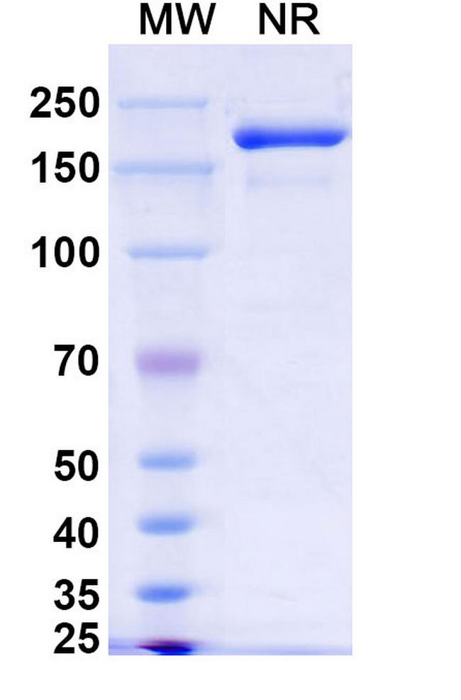 Xeligekimab Humanized Antibody in SDS-PAGE (SDS-PAGE)