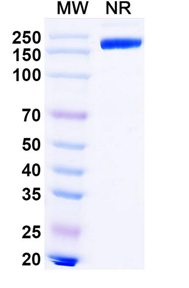 Lipustobart Antibody in SDS-PAGE (SDS-PAGE)
