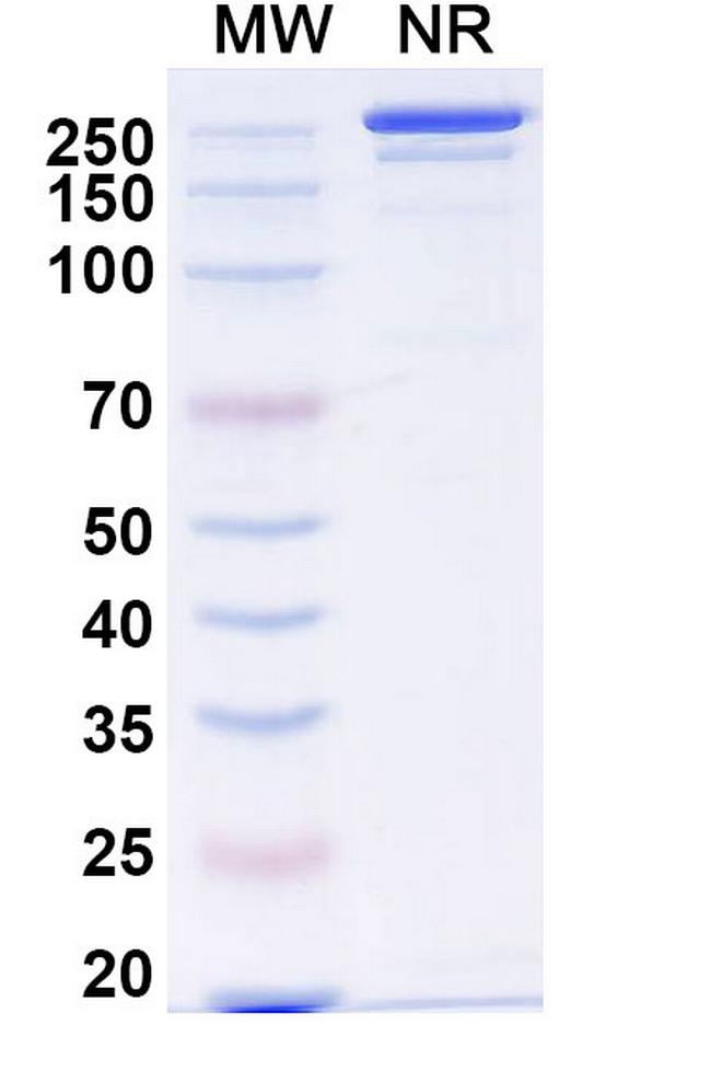 Lomvastomig Antibody in SDS-PAGE (SDS-PAGE)
