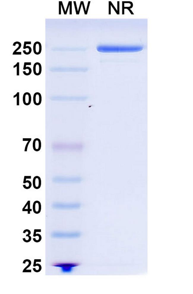 PCSK9 (Recaticimab Biosimilar) Antibody in SDS-PAGE (SDS-PAGE)