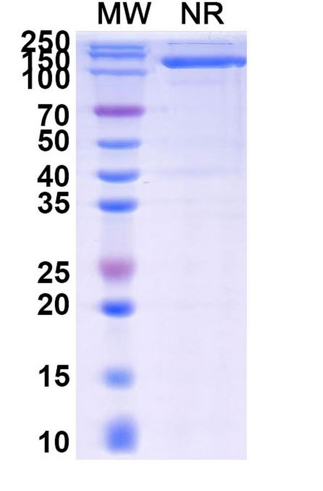 BTLA (CD272) (Venanprubart Biosimilar) Antibody in SDS-PAGE (SDS-PAGE)