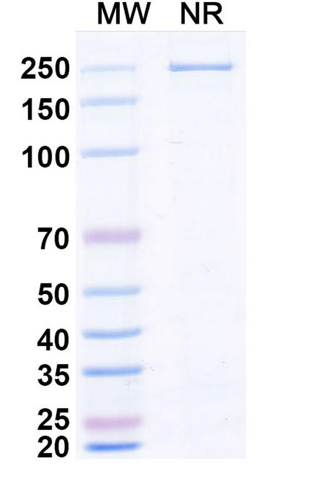 Zaltenibart Chimeric Antibody in SDS-PAGE (SDS-PAGE)