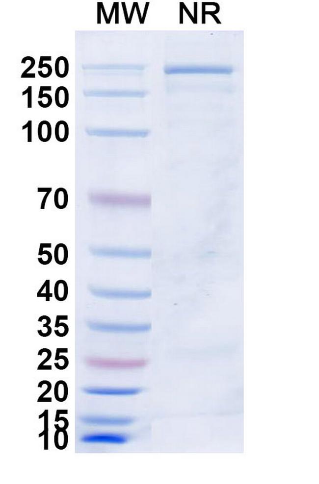 Azirkitug Humanized Antibody in SDS-PAGE (SDS-PAGE)