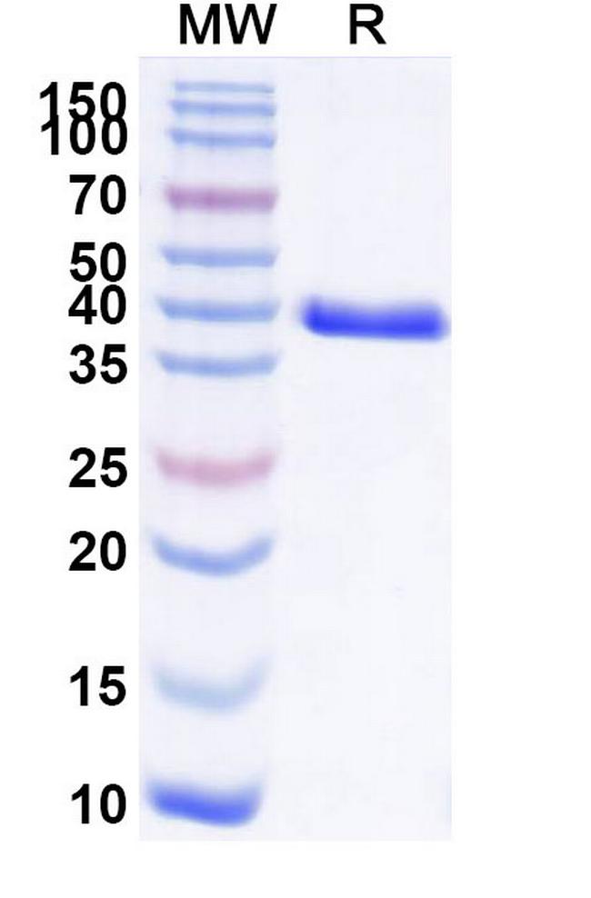 CEACAM6 Antibody in SDS-PAGE (SDS-PAGE)
