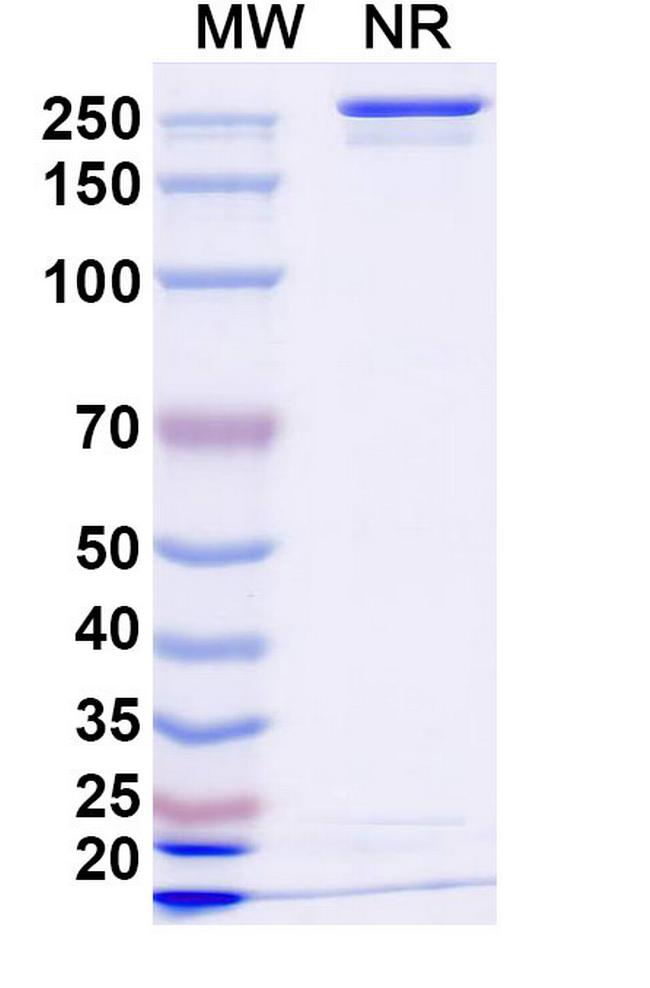Anzurstobart Antibody in SDS-PAGE (SDS-PAGE)