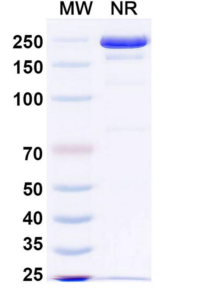 Epacmarstobart Antibody in SDS-PAGE (SDS-PAGE)
