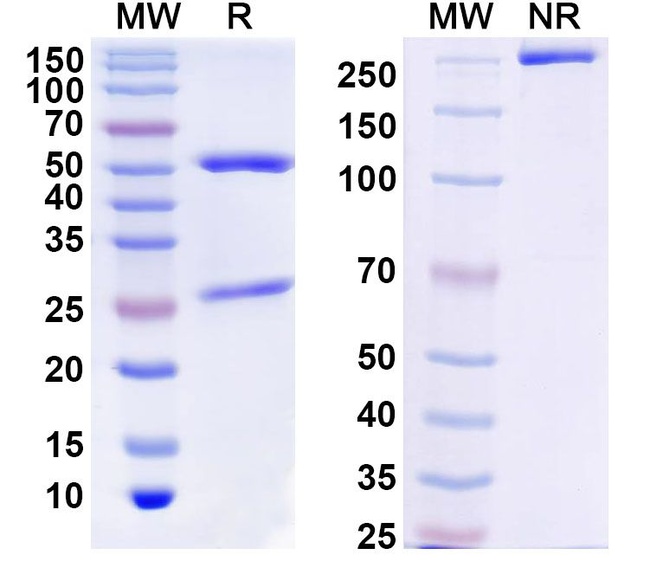 Anbenitamab Humanized Antibody in SDS-PAGE (SDS-PAGE)