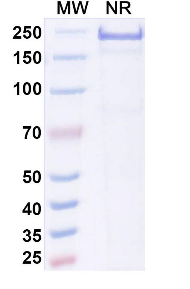 Adakitug Antibody in SDS-PAGE (SDS-PAGE)