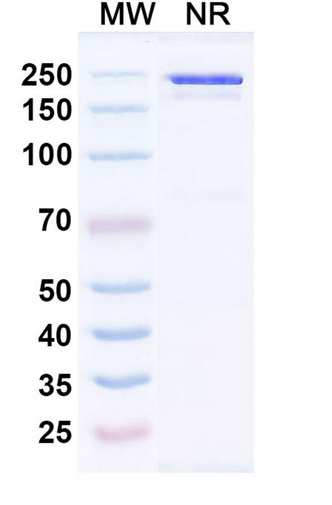 Bremzalerbart Antibody in SDS-PAGE (SDS-PAGE)