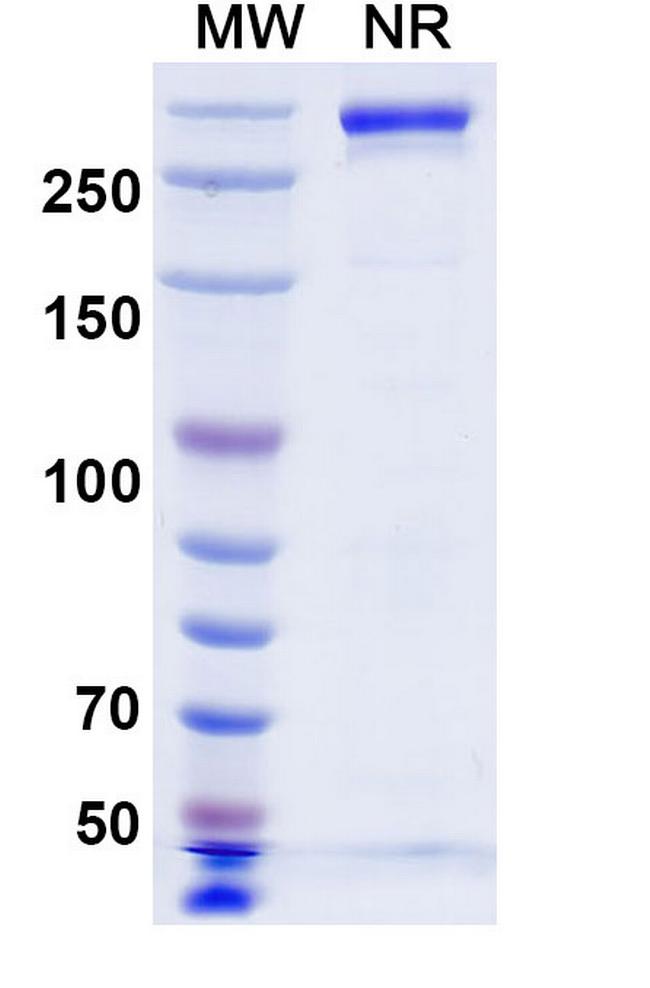 Beludavimab Antibody in SDS-PAGE (SDS-PAGE)