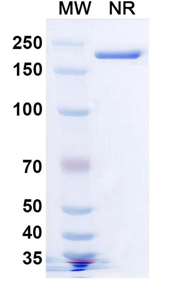 Lomtegovimab Antibody in SDS-PAGE (SDS-PAGE)