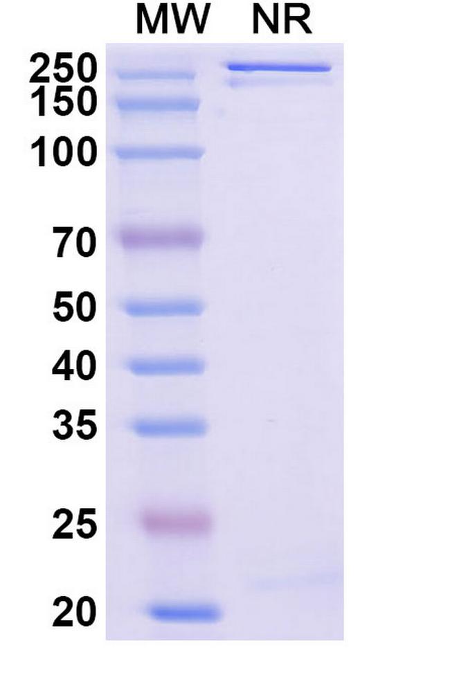 Enuzovimab Antibody in SDS-PAGE (SDS-PAGE)