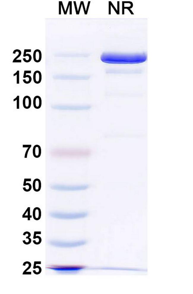 JMB2002 (Ab2001.08) Antibody in SDS-PAGE (SDS-PAGE)
