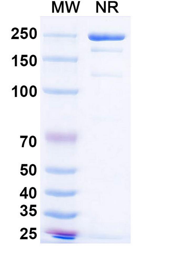 Simaravibart Antibody in SDS-PAGE (SDS-PAGE)
