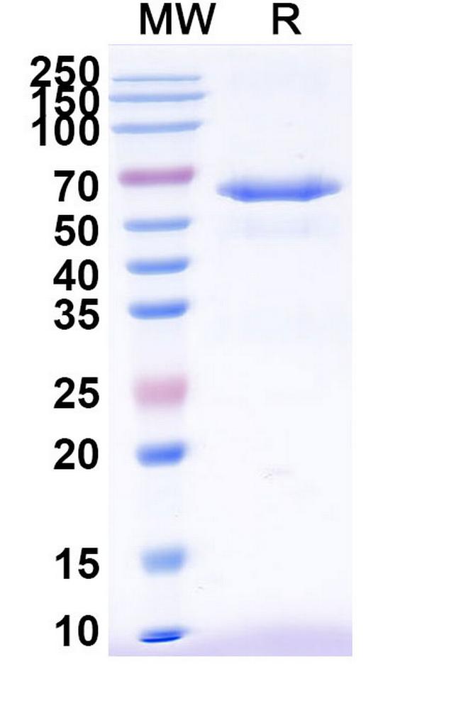 TRAIL-R2 (DR5) Antibody in SDS-PAGE (SDS-PAGE)