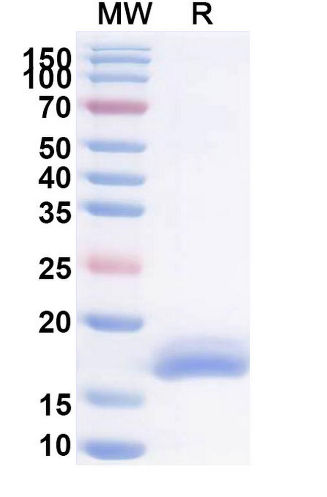 RSV Fusion Protein Antibody in SDS-PAGE (SDS-PAGE)