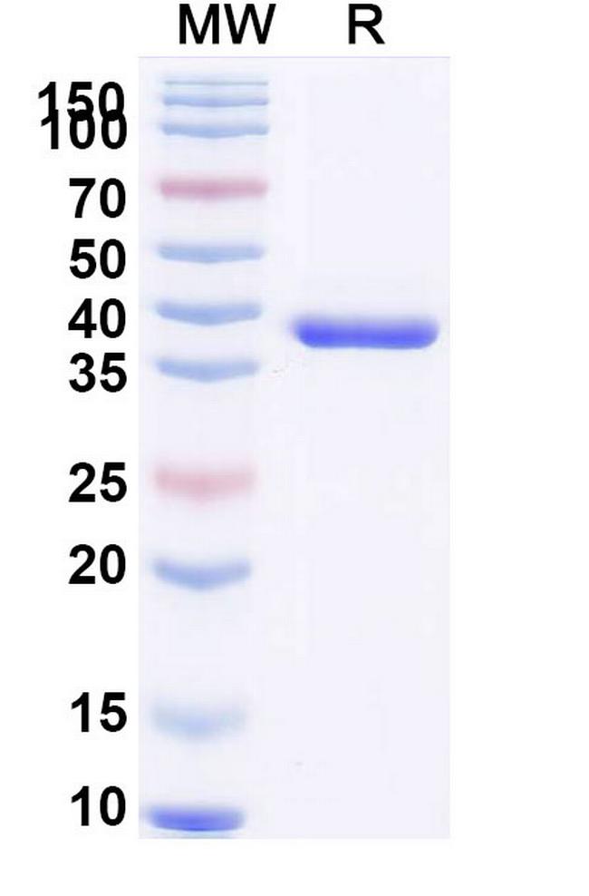 BC2 Tag Antibody in SDS-PAGE (SDS-PAGE)