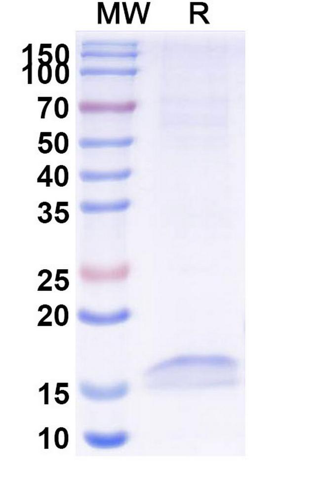 Cannabinoid Receptor 1 VHH-8His-Cys-tag Antibody in SDS-PAGE (SDS-PAGE)