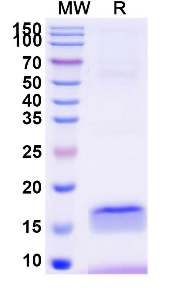 B7-H3 VHH-6His Antibody in SDS-PAGE (SDS-PAGE)