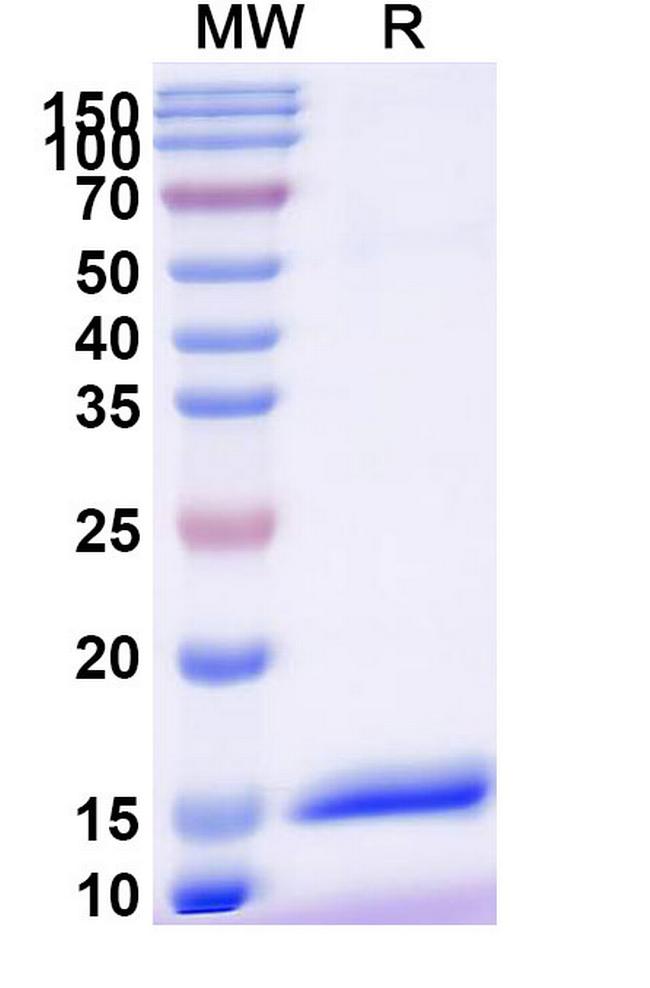 CX3CR1 VHH-8His-Cys-tag Antibody in SDS-PAGE (SDS-PAGE)