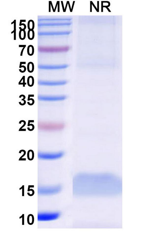 Transferrin Receptor VHH-8His-Cys-tag Antibody in SDS-PAGE (SDS-PAGE)