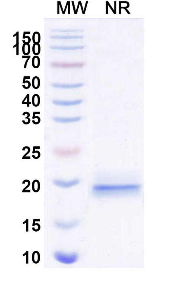 VWF VHH-8His-Cys-tag Antibody in SDS-PAGE (SDS-PAGE)