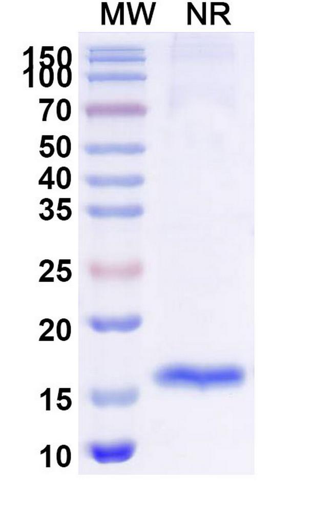 ADAMTS13 VHH-8His-Cys-tag Antibody in SDS-PAGE (SDS-PAGE)