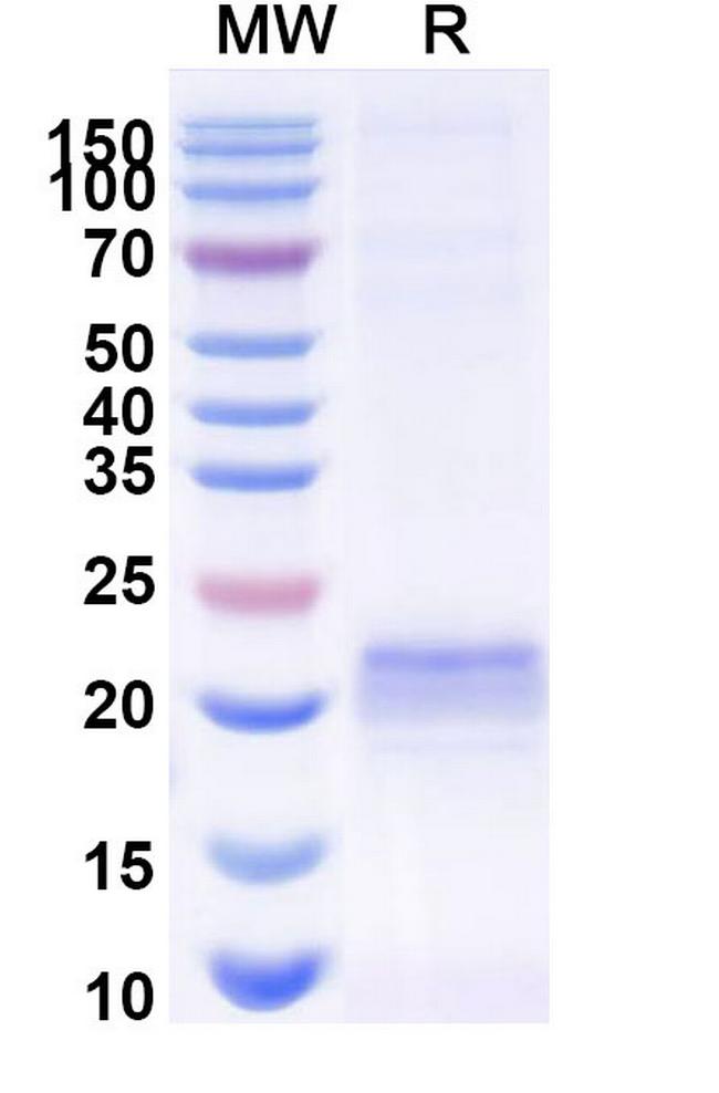 ARC VHH-Avi-8His-Cys-tag Antibody in SDS-PAGE (SDS-PAGE)